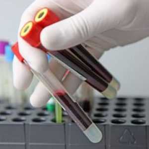 Test de sânge general pentru HIV: numirea și modificarea parametrilor