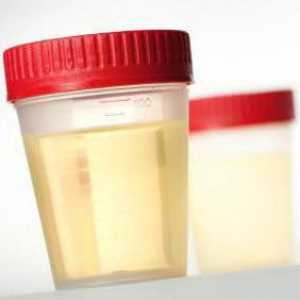 Sumar de urina unui copil: reguli de masă și interpretarea rezultatelor, caracteristicile…