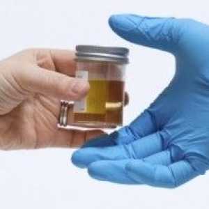 Analiza urinei: semnificație și pregătirea adecvată pentru livrarea de analiză