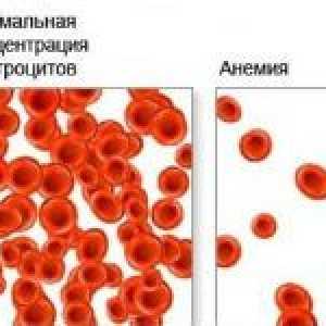 Principalele cauze ale anemiei