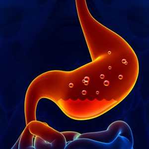 Burn stomac - cauze, simptome și tratament