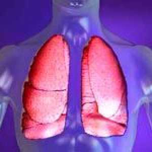 Pneumonie (inflamație pulmonară). Tratamentul de remedii populare.