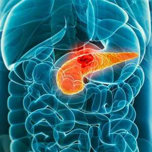 Pentru unele simptome determinate de cancer pancreatic