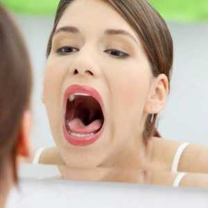 De ce sângerare limba: cauze si tratament