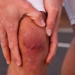 De ce este umflat si dureri de genunchi