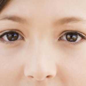 Care sunt cauzele umflarea ochilor și cum să scape de ele repede