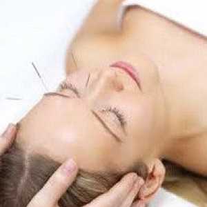 Ajuta acupunctura cu nevrită de nerv facial