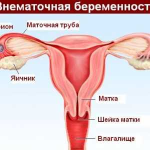 Conceptul de abdomen acut in ginecologie si chirurgie