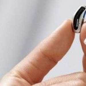 Beneficiile de aparate auditive Siemens: calitate și fiabilitate ridicată