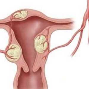 Boli ginecologice in timpul menopauzei