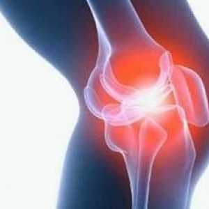 Cauzele și tratamentul durerii articulare la menopauza