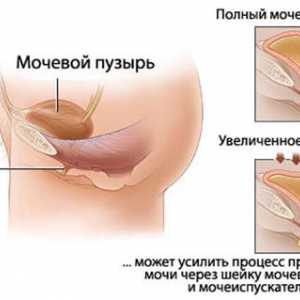 Cauzele incontinenta urinara la menopauza
