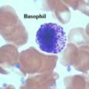 Motivele pentru creșterea bazofile în sângele pentru adulți