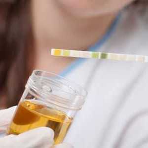 Motivele pentru conținutul crescut de proteine ​​în urină de bărbați