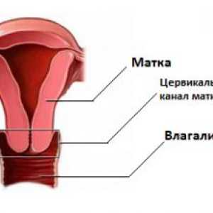 Cauzele dilatare de col uterin la femeile aflate la menopauza
