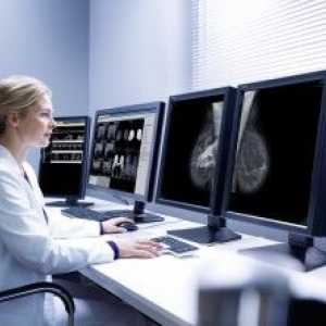Motivele pentru dezvoltarea și tratamentul fibrozei al sânului