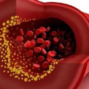 Ce chol în analiza biochimică a sângelui