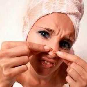 Terapeutul te ajuta sa scapi de acnee