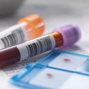 Descifrarea analiza biochimică a parametrilor de sange la copii