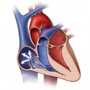 Valve cardiace regurgitarea: simptome, masura, diagnostic, tratament