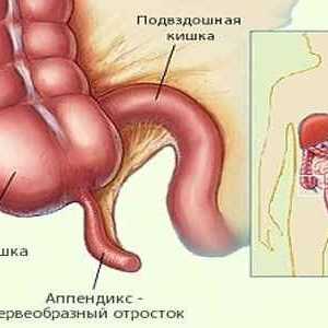 Metode pentru diagnosticarea apendicita