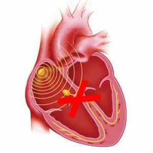 Bloc cardiac:, diverse locații complete și parțiale - cauze, simptome, tratament