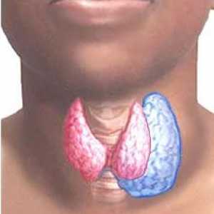 Simptome si tipuri de cancer tiroidian