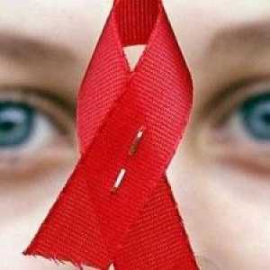 Simptome de HIV