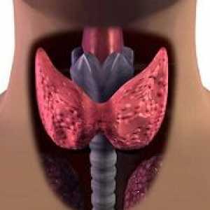 Extindere a glandei tiroide