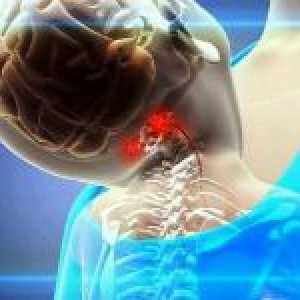 Sindromul arterei vertebrale