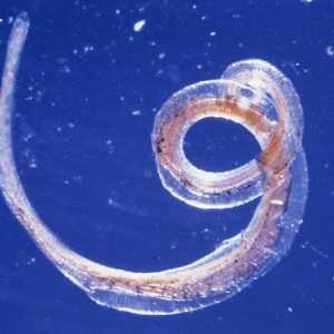 Sipptomy și tratamentul Whipworm uman