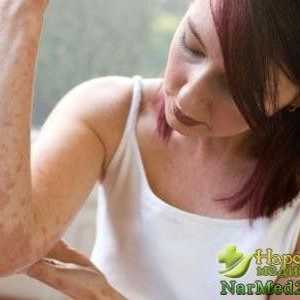 Sfaturi pentru tratamentul dermatitei atopice la domiciliu