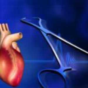 Cum de a trata boli de inima