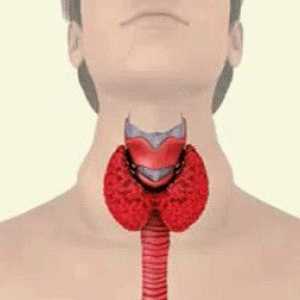 Gusa thyrotoxic