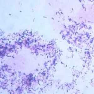 Ureaplasma urealitikum (Ureaplasma urealyticum): ce este și ce să facă în cazul în care o infecție…