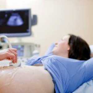 Uzi in timpul sarcinii: cât de multe săptămâni de a face 3 Uzi