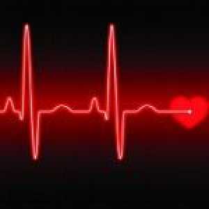 Simptome si diagnostic de aritmii cardiace