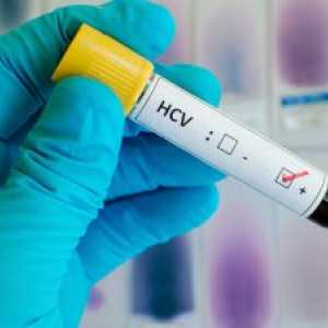 Sarcina virală în hepatita cu: tipuri de teste și interpretarea rezultatelor