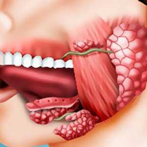Inflamatia glandei salivare: tratament la domiciliu