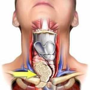 Toate hipoplazie a glandei tiroide: ce este, care sunt simptomele și cum să fie tratate dacă…
