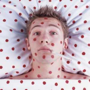 Rashes pe piele sub formă de puncte roșii: o infecție sau nu?