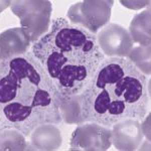 Ce neutrofilelor în sânge