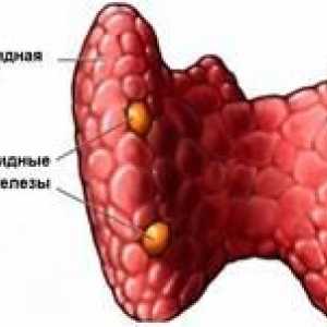 Boala a hiperparatiroidismul sistemului endocrin, simptome și tratament