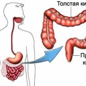Pneumatoză intestinale Boala