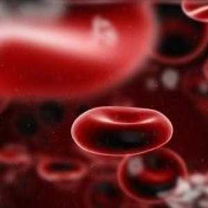 Tulburări de sânge: o listă cu cele mai frecvente și mai grave boli