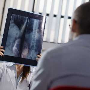 De ce este o radiografie a stomacului cu bariu?
