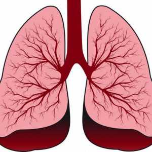 Congestie pulmonară la vârstnici